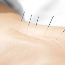 izmir akupunktur