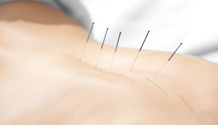 izmir akupunktur