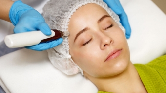 SAÇ DÖKÜLMESİ TEDAVİSİNDE DERMAPEN